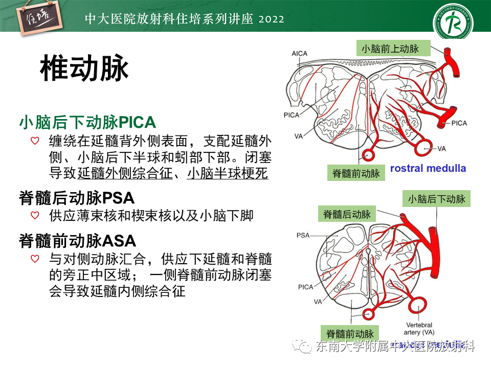 影像PPT - 【PPT】大脑后循环供血区脑梗死影像学表现-26