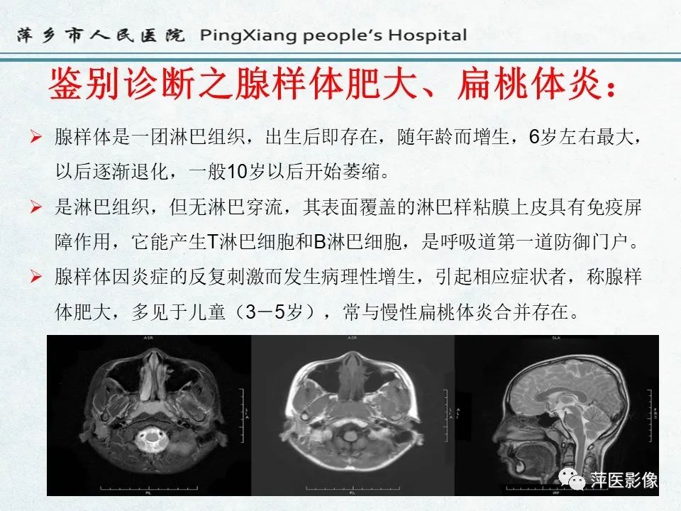 影像PPT - 【PPT】鼻咽部肿瘤影像学上的异同-36