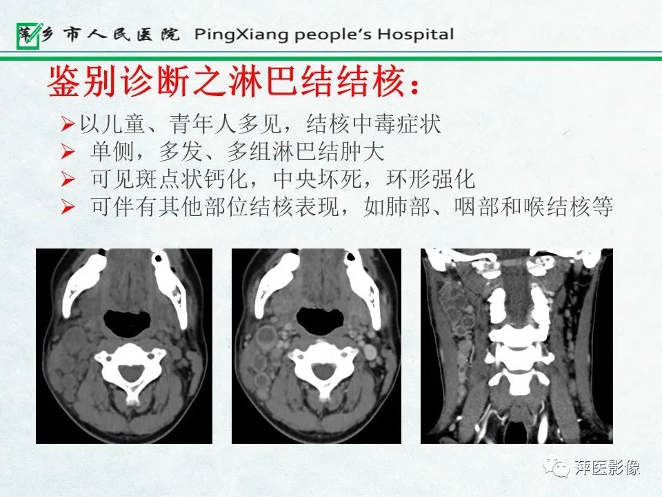 影像PPT - 【PPT】鼻咽部肿瘤影像学上的异同-40