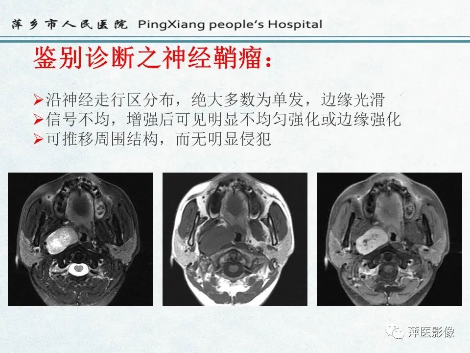 影像PPT - 【PPT】鼻咽部肿瘤影像学上的异同-41