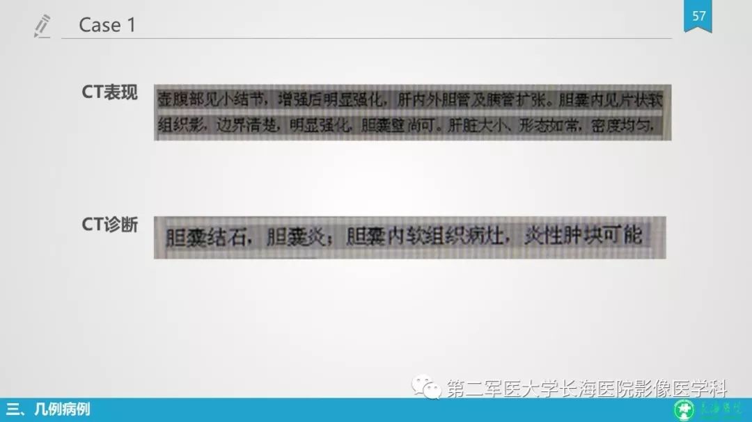 影像PPT - 【PPT】胆囊良性病变及其影像学特征-56