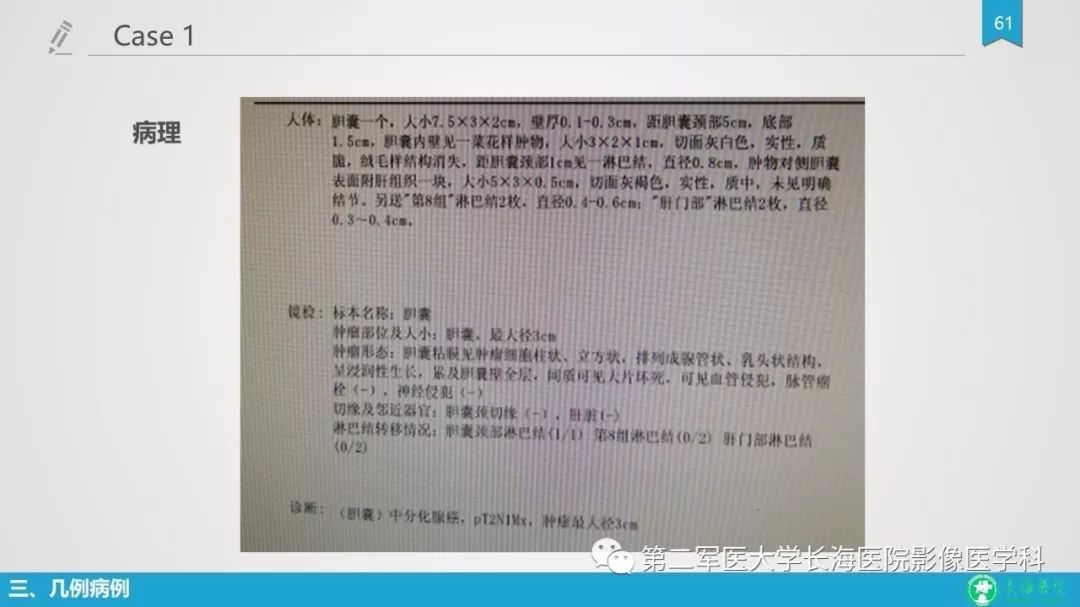 影像PPT - 【PPT】胆囊良性病变及其影像学特征-60