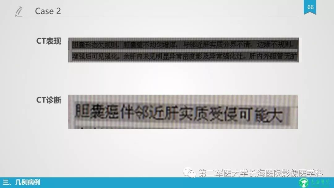 影像PPT - 【PPT】胆囊良性病变及其影像学特征-65