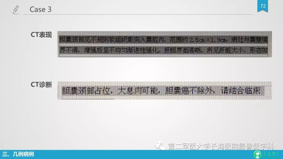 影像PPT - 【PPT】胆囊良性病变及其影像学特征-71