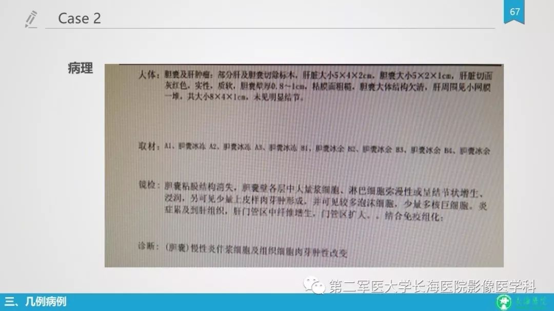 影像PPT - 【PPT】胆囊良性病变及其影像学特征-66