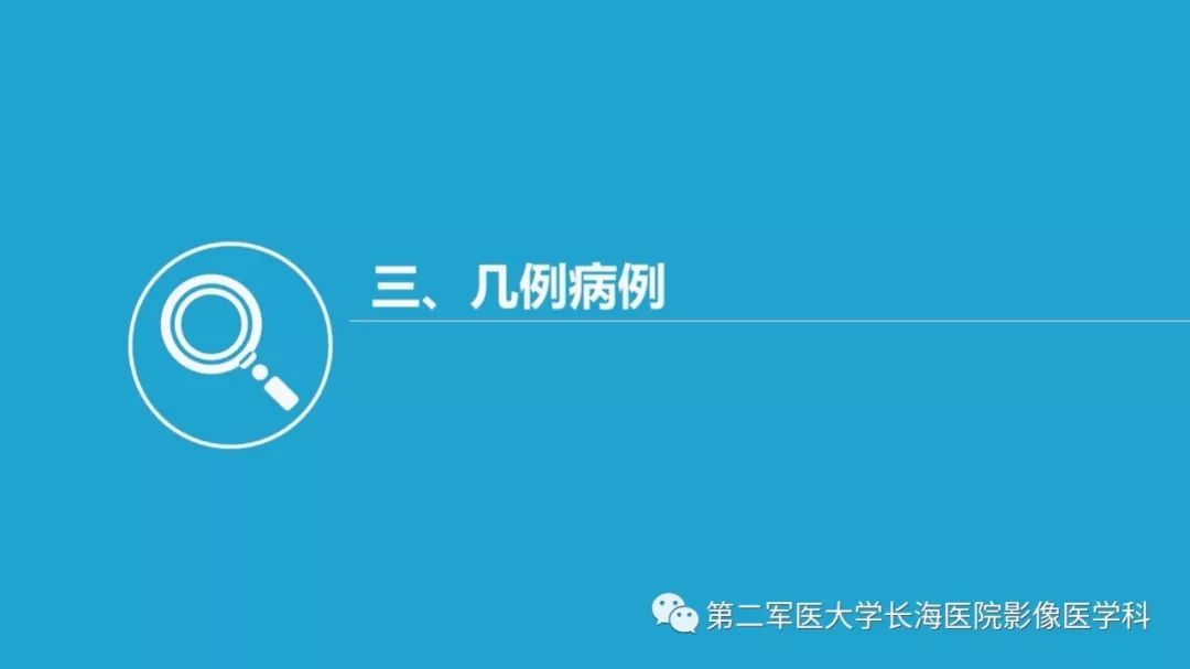 影像PPT - 【PPT】胆囊良性病变及其影像学特征-52