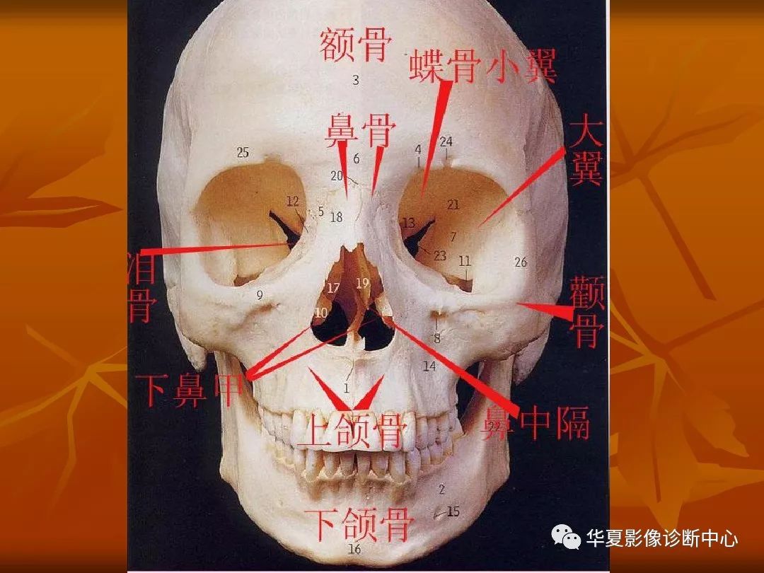 影像PPT - 【PPT】颅骨外伤性骨折CT诊断-6