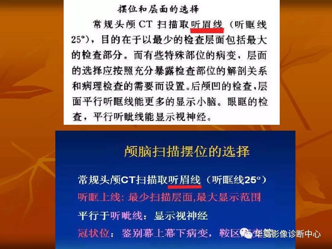 影像PPT - 【PPT】颅骨外伤性骨折CT诊断-14