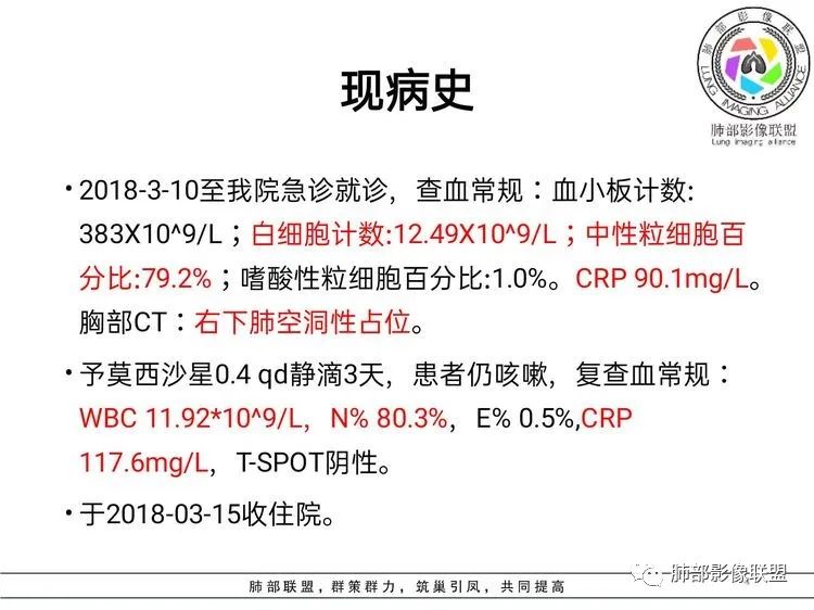 影像PPT - 【病例】难得一见的单发空洞型肺隐球菌感染-3 影像PPT - 【病例】难得一见的单发空洞型肺隐球菌感染-3