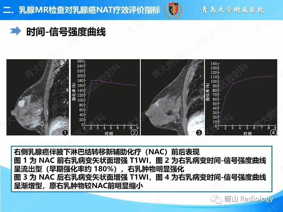 影像PPT - 【PPT】MRI评估乳腺癌新辅助治疗疗效-7