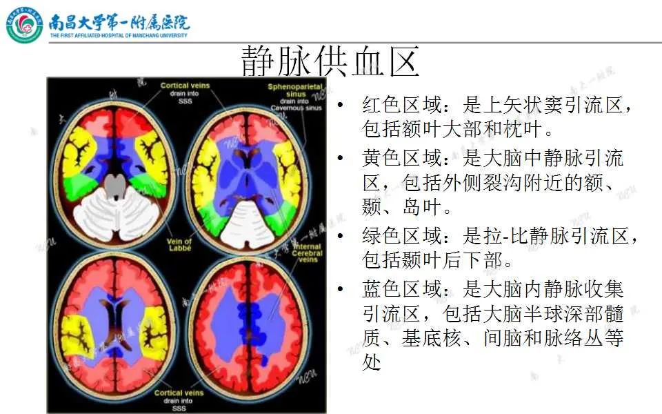 影像PPT - 【PPT】颅内静脉病变及相关卒中的影像学诊断-6