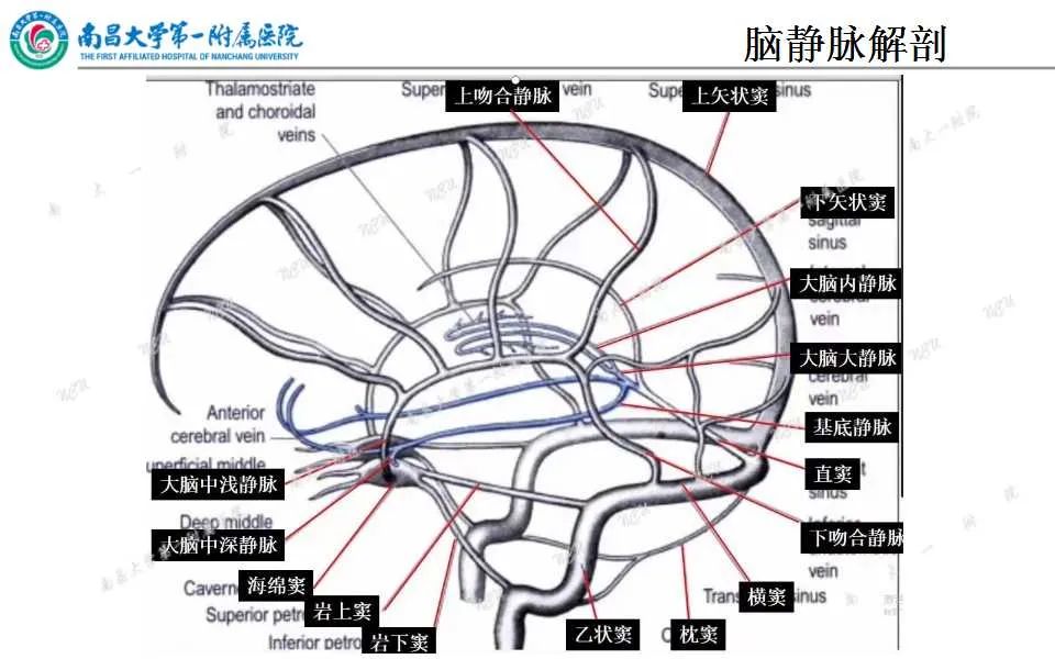 影像PPT - 【PPT】颅内静脉病变及相关卒中的影像学诊断-3
