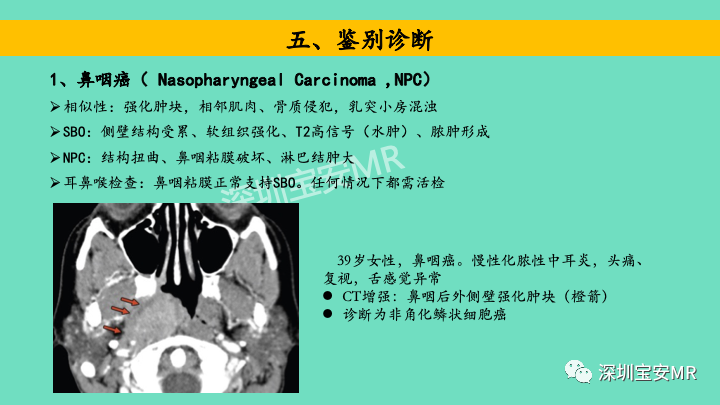 影像PPT - 【PPT】颅底骨髓炎影像诊断-17