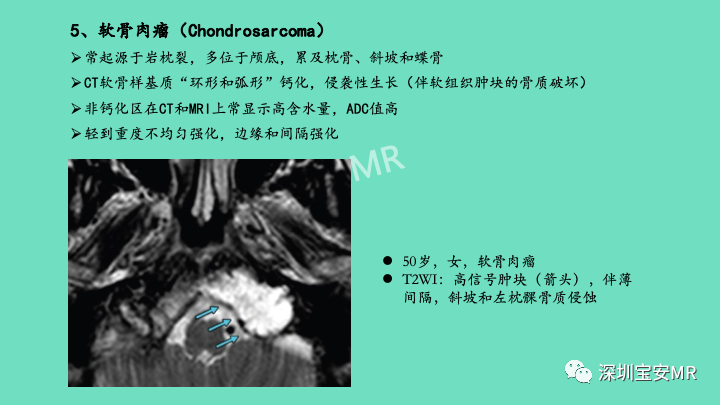 影像PPT - 【PPT】颅底骨髓炎影像诊断-23