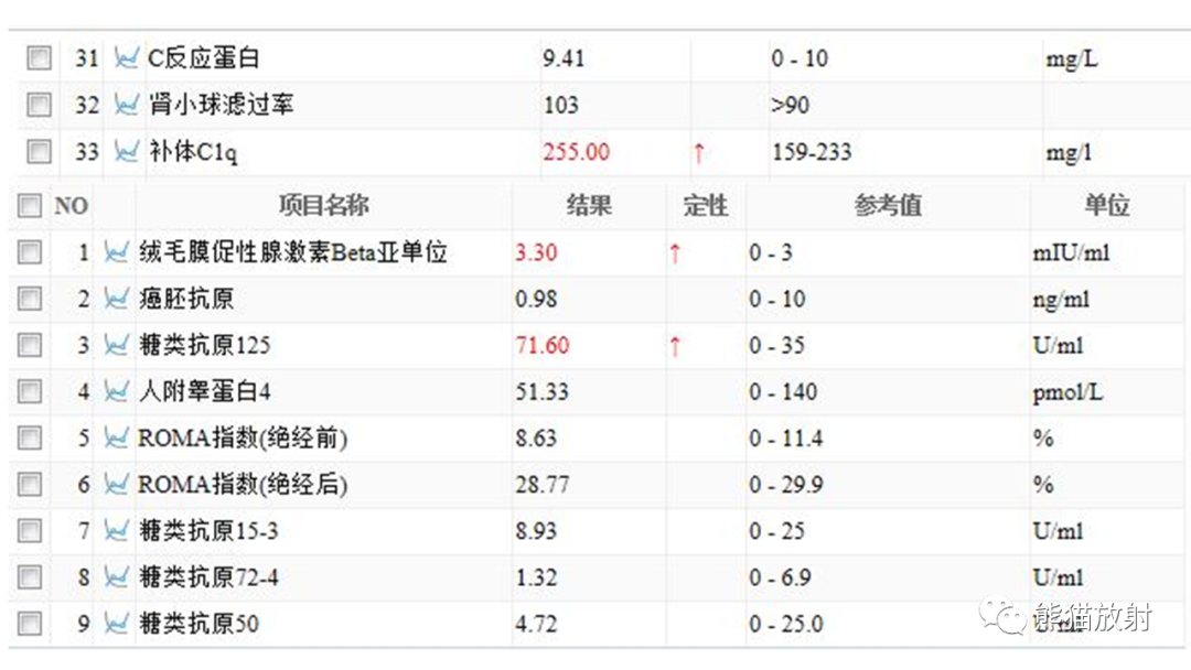 影像PPT - 【病例】卵巢卵泡膜纤维瘤2例MR影像-3