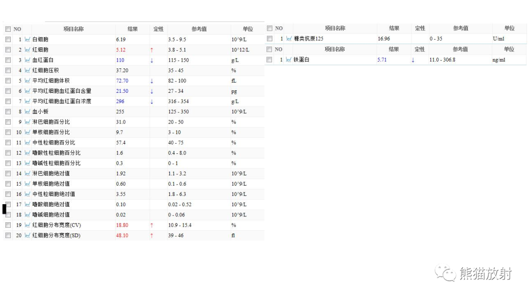 影像PPT - 【病例】卵巢卵泡膜纤维瘤2例MR影像-18
