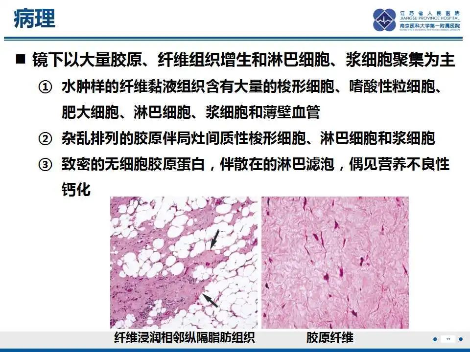 影像PPT - 【PPT】纤维素性纵隔炎-23