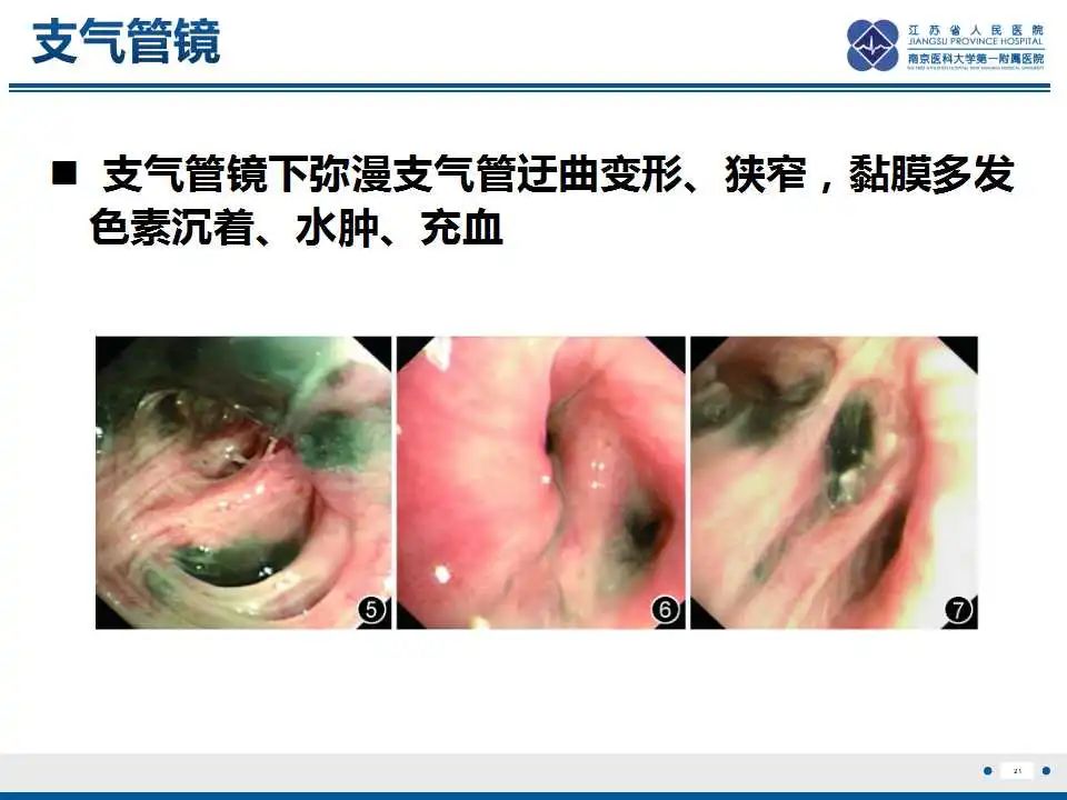 影像PPT - 【PPT】纤维素性纵隔炎-22