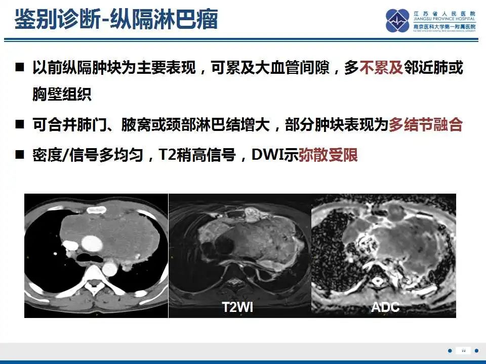 影像PPT - 【PPT】纤维素性纵隔炎-33