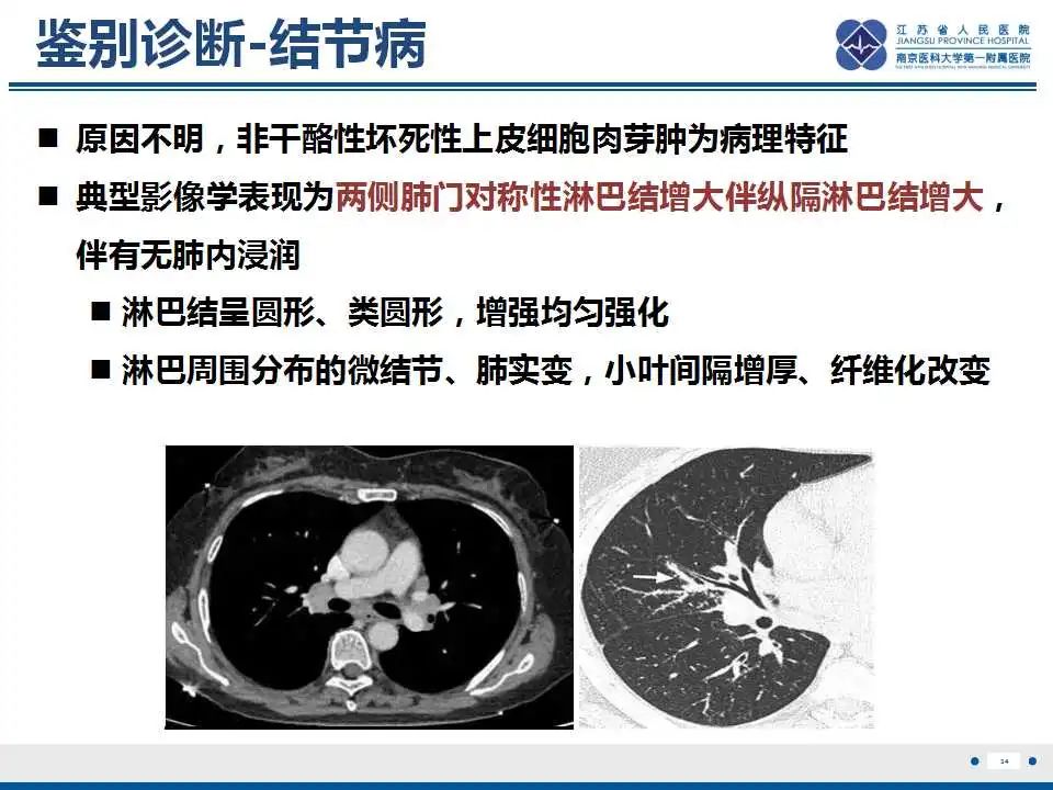 影像PPT - 【PPT】纤维素性纵隔炎-35