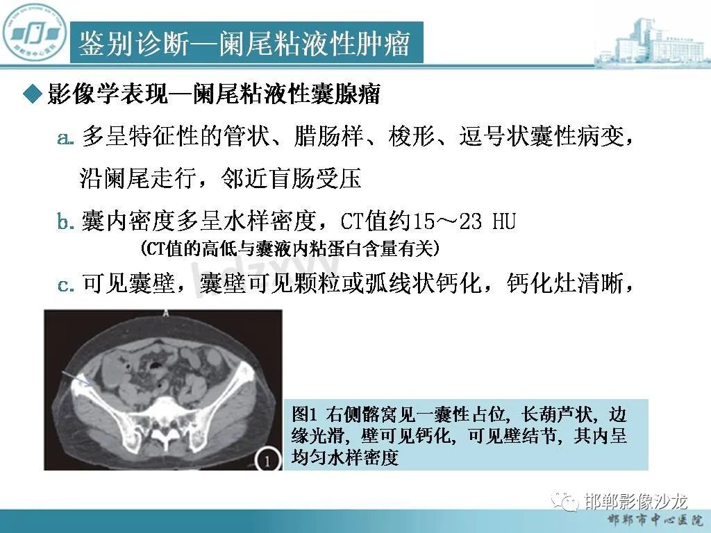 影像PPT - 【PPT】良性多囊性腹膜间皮瘤影像诊断-30