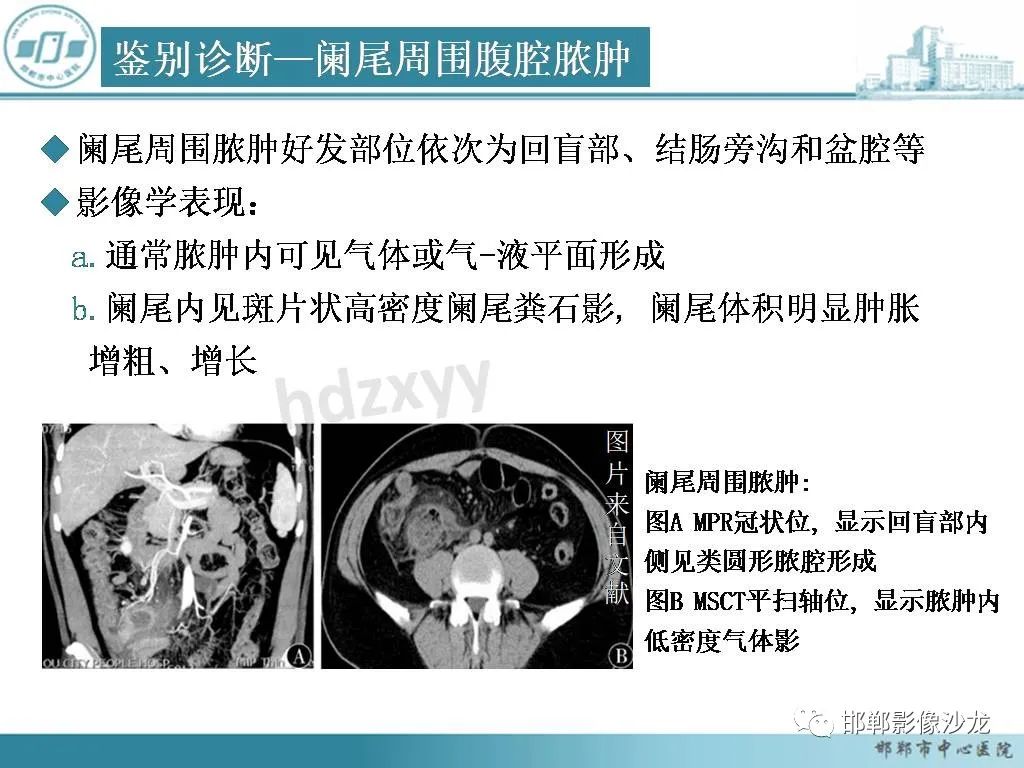 影像PPT - 【PPT】良性多囊性腹膜间皮瘤影像诊断-35
