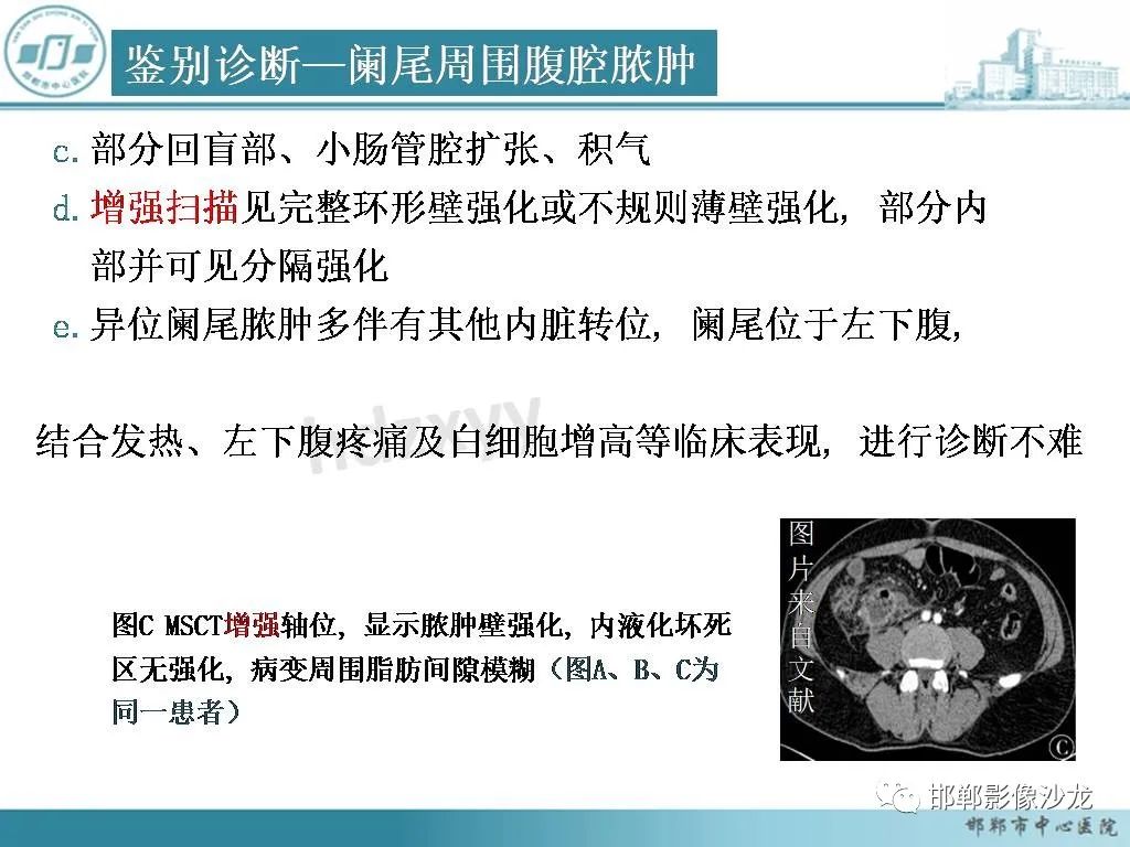 影像PPT - 【PPT】良性多囊性腹膜间皮瘤影像诊断-36