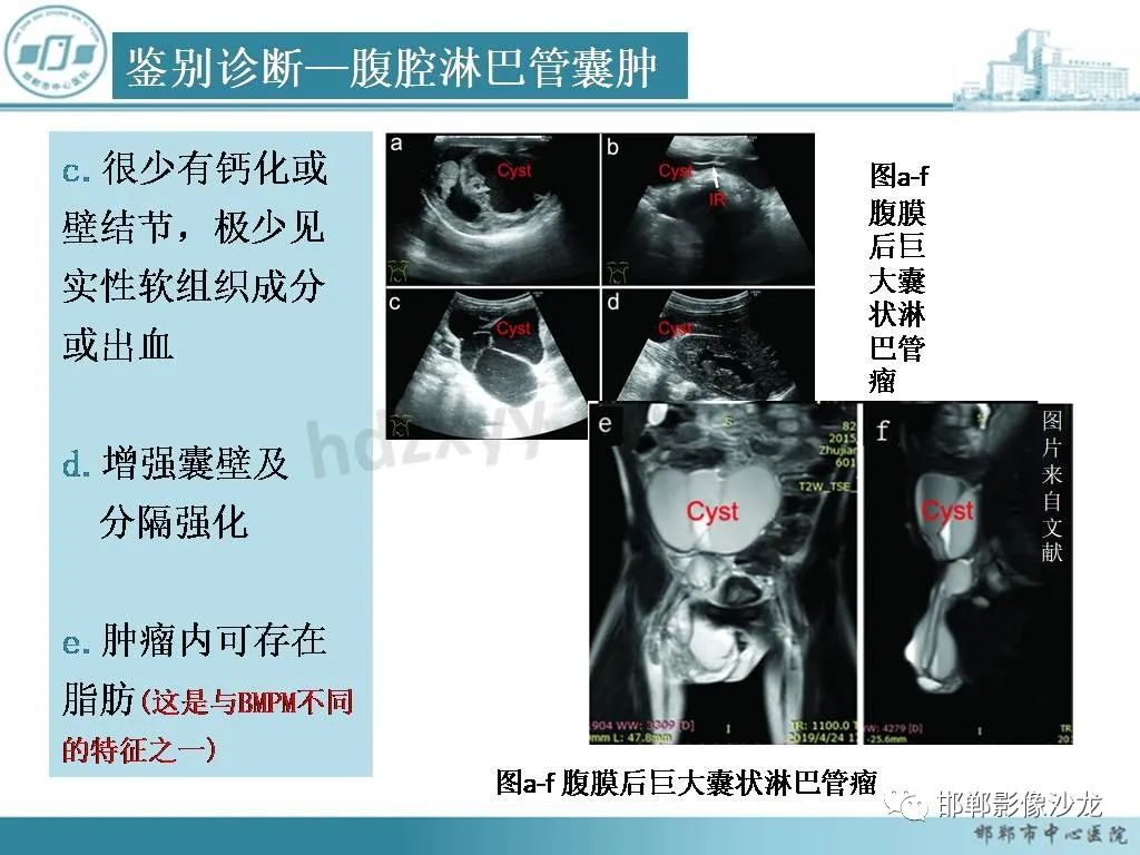 影像PPT - 【PPT】良性多囊性腹膜间皮瘤影像诊断-1