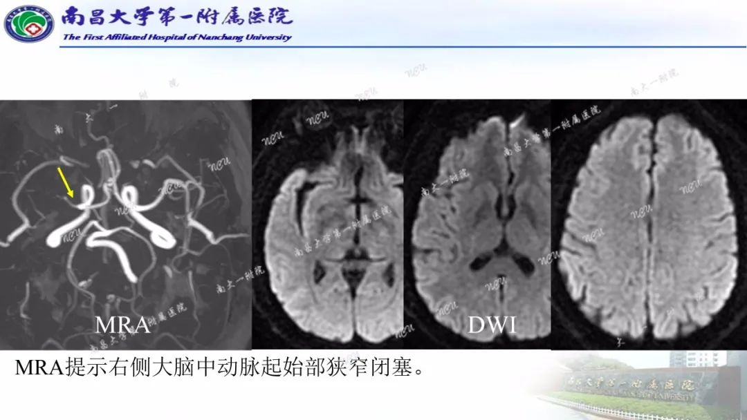 影像PPT - 【PPT】磁共振ASL成像原理及临床应用-6