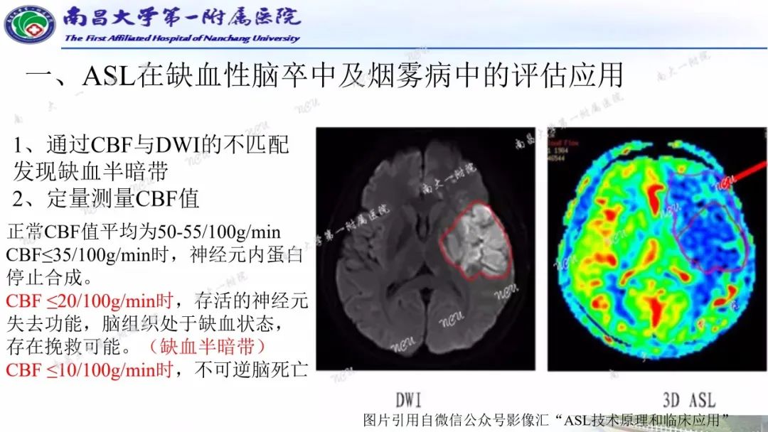 影像PPT - 【PPT】磁共振ASL成像原理及临床应用-5