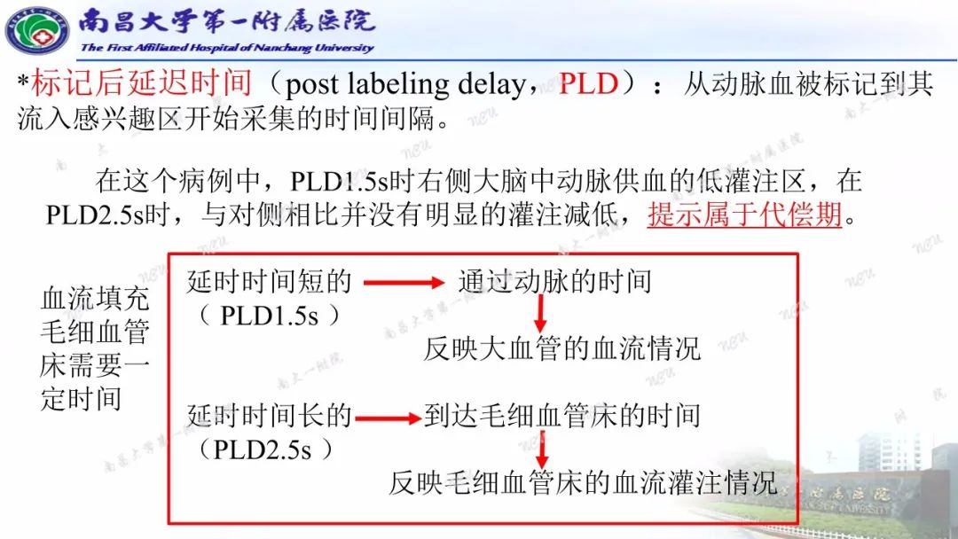 影像PPT - 【PPT】磁共振ASL成像原理及临床应用-8