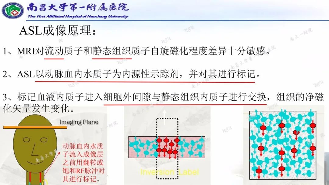 影像PPT - 【PPT】磁共振ASL成像原理及临床应用-3