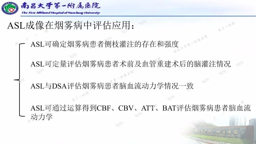 影像PPT - 【PPT】磁共振ASL成像原理及临床应用-18