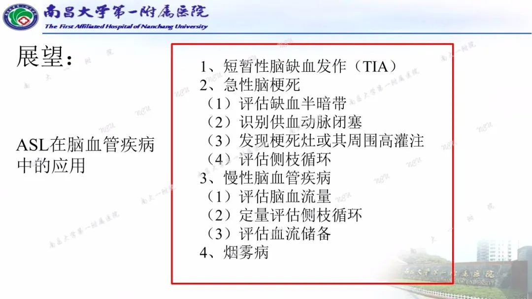 影像PPT - 【PPT】磁共振ASL成像原理及临床应用-28