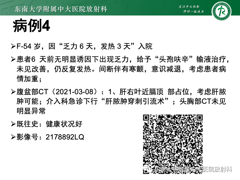 影像PPT - 【PPT】弥漫脑膜强化病变的影像诊断-12