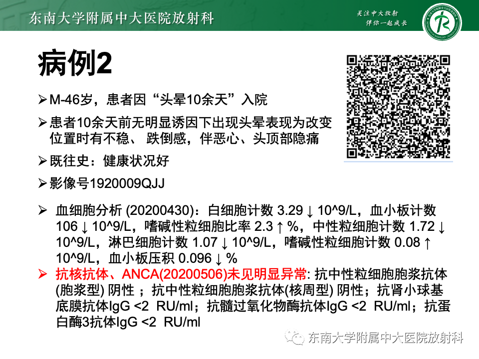 影像PPT - 【PPT】弥漫脑膜强化病变的影像诊断-4