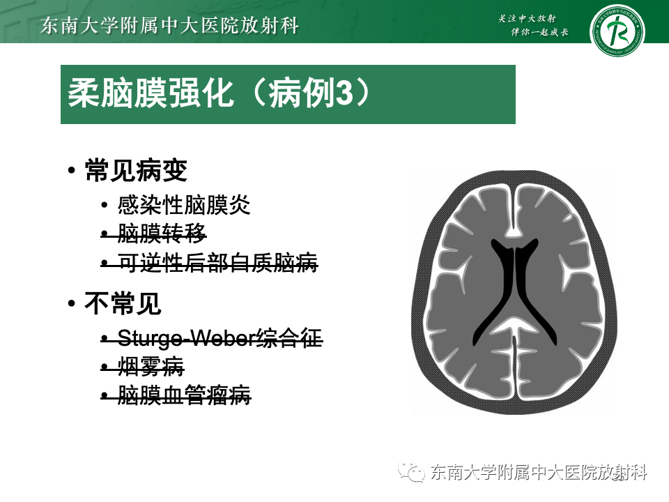 影像PPT - 【PPT】弥漫脑膜强化病变的影像诊断-36