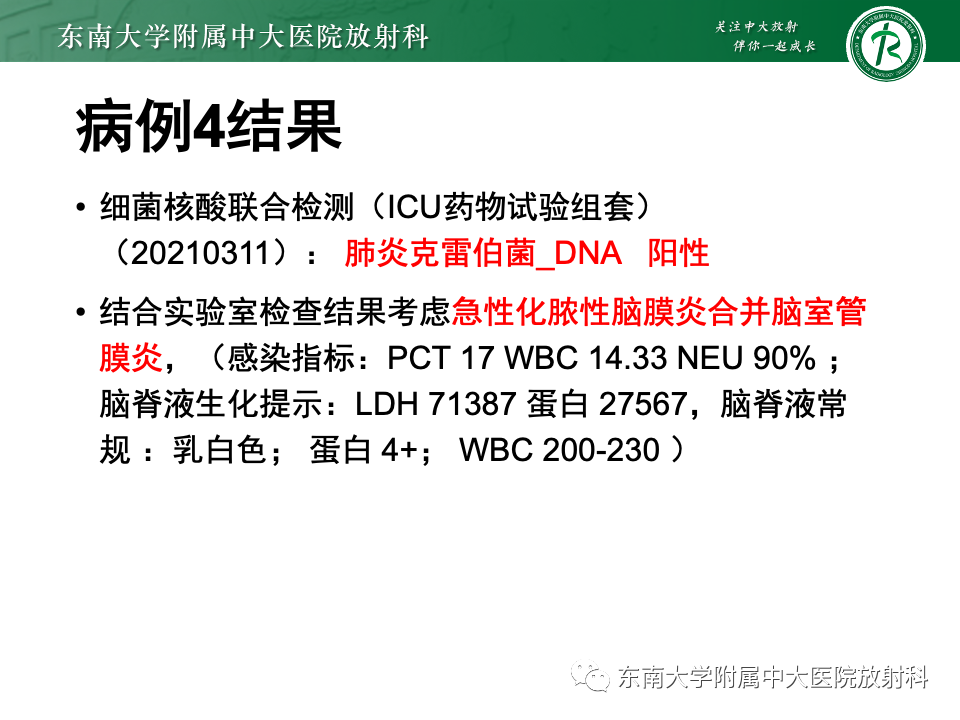 影像PPT - 【PPT】弥漫脑膜强化病变的影像诊断-21