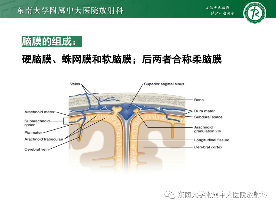 影像PPT - 【PPT】弥漫脑膜强化病变的影像诊断-27