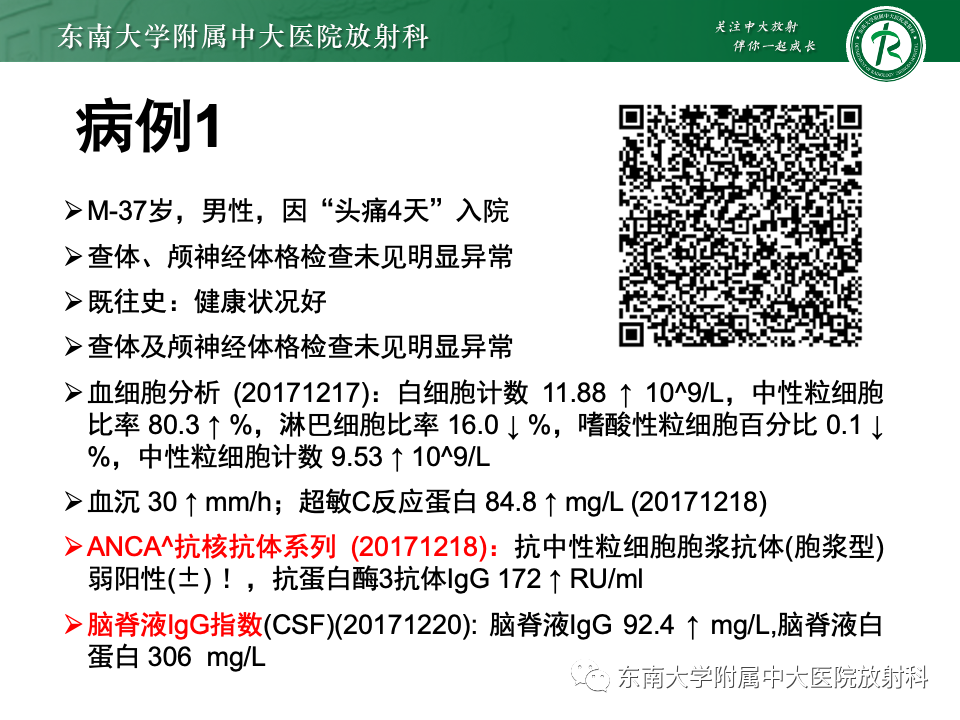 影像PPT - 【PPT】弥漫脑膜强化病变的影像诊断-1