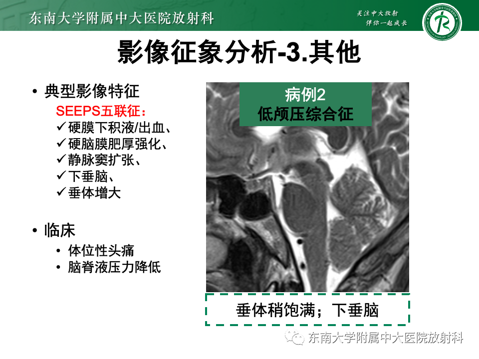 影像PPT - 【PPT】弥漫脑膜强化病变的影像诊断-42