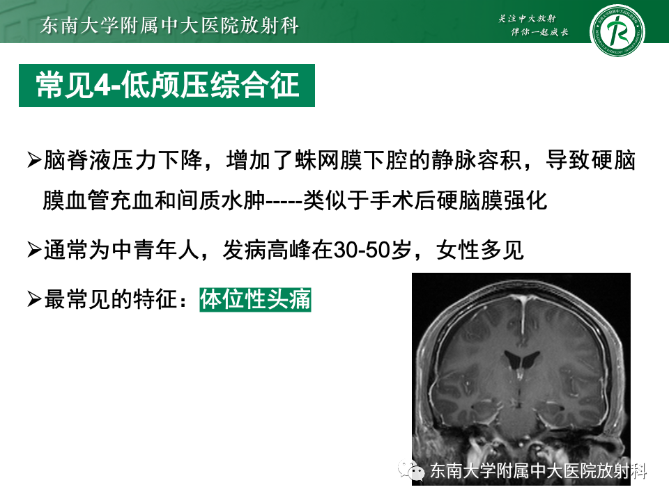 影像PPT - 【PPT】弥漫脑膜强化病变的影像诊断-62