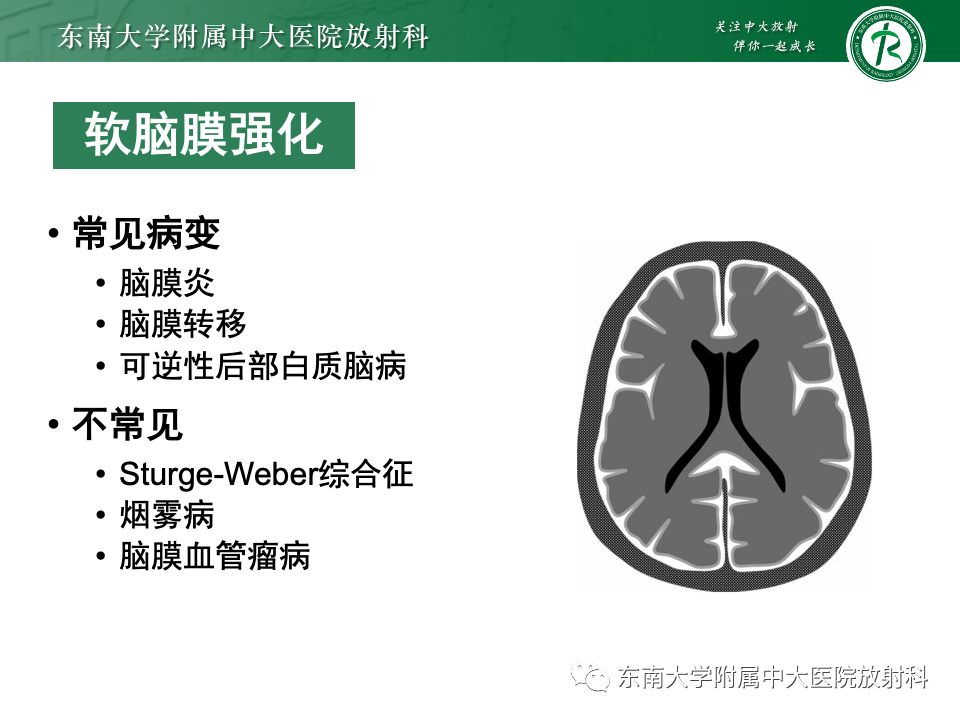 影像PPT - 【PPT】弥漫脑膜强化病变的影像诊断-69