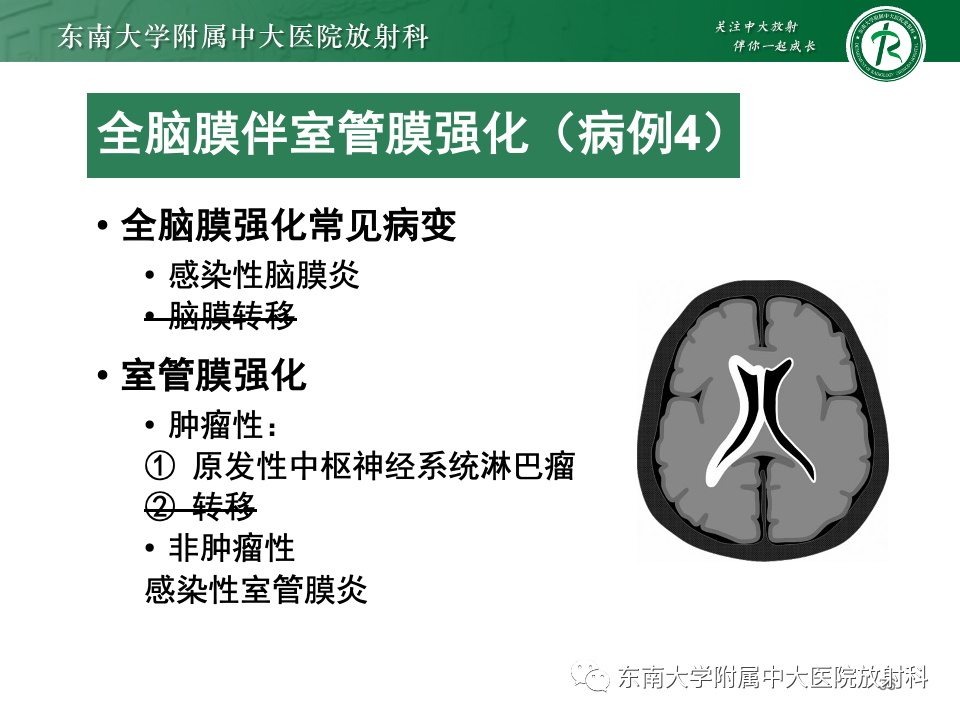 影像PPT - 【PPT】弥漫脑膜强化病变的影像诊断-6