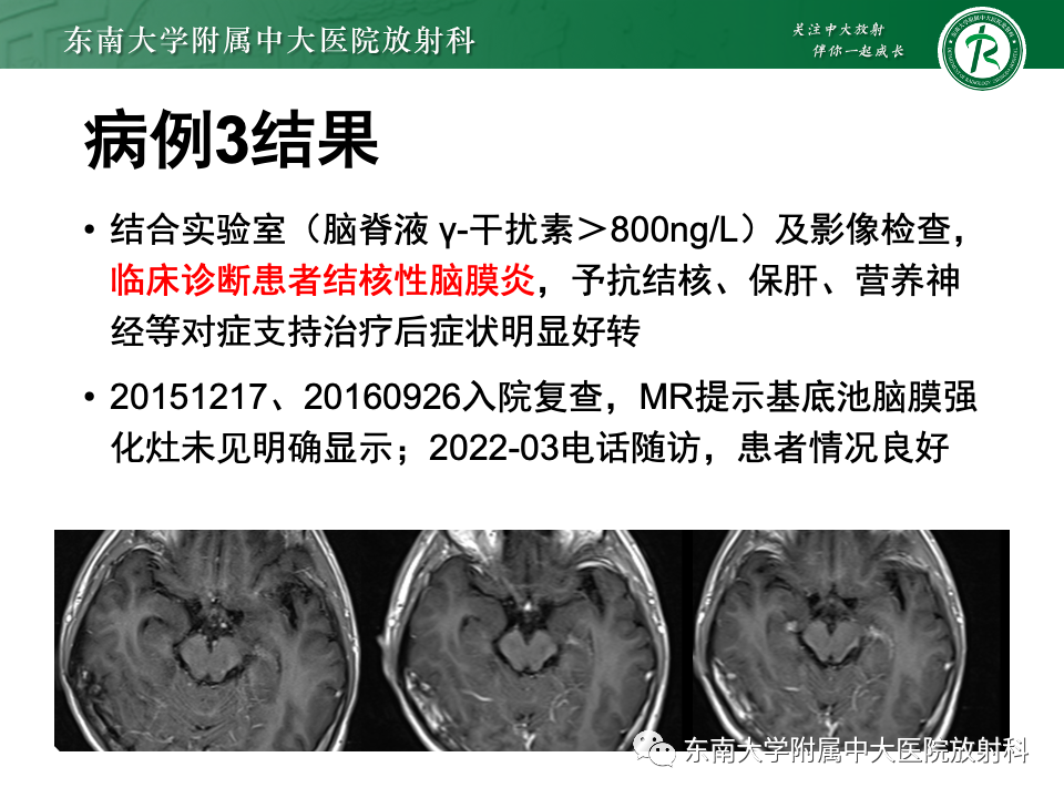 影像PPT - 【PPT】弥漫脑膜强化病变的影像诊断-3