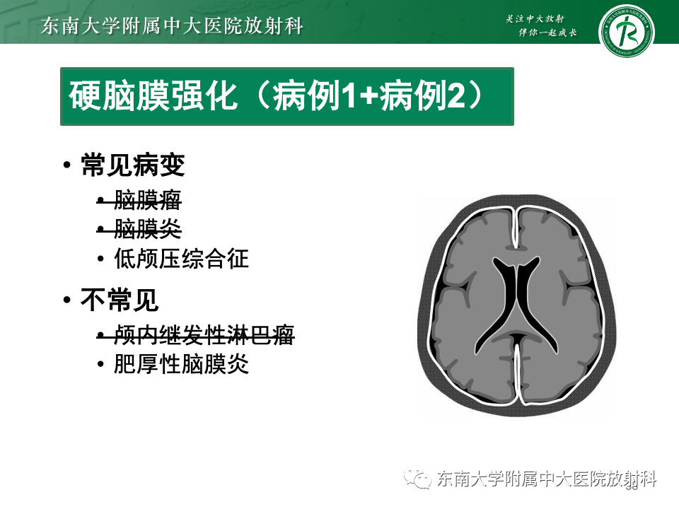 影像PPT - 【PPT】弥漫脑膜强化病变的影像诊断-7