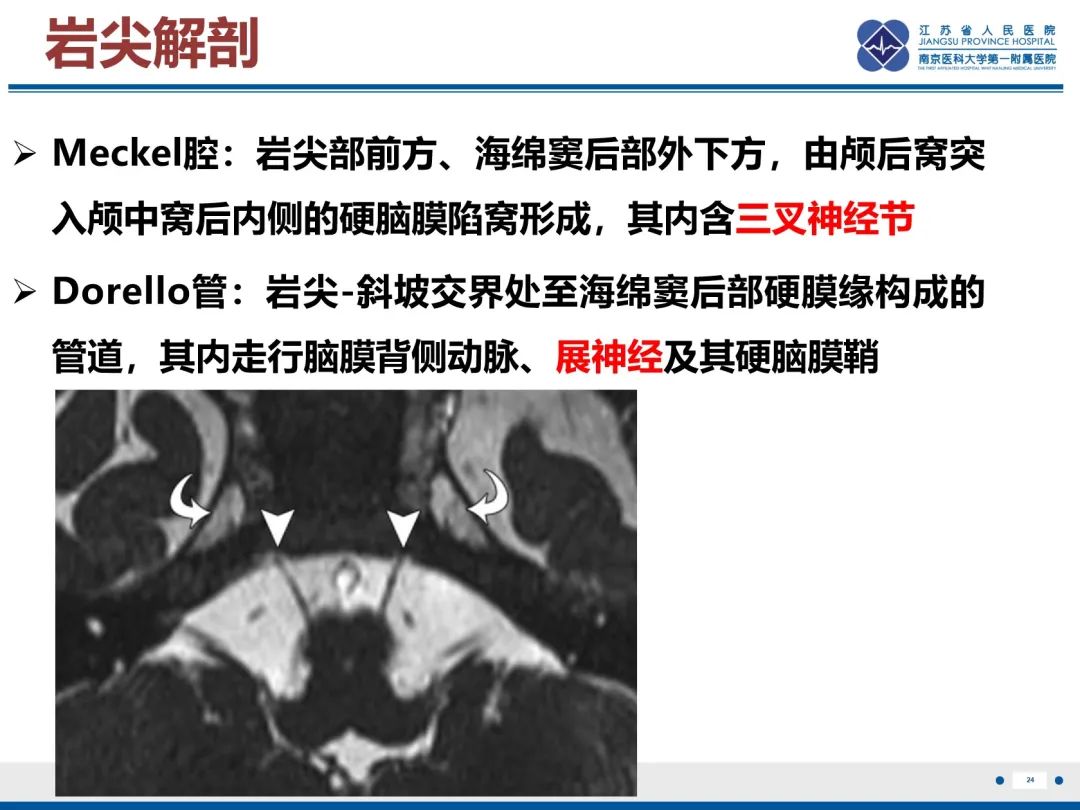 影像PPT - 【PPT】岩尖胆脂瘤-25