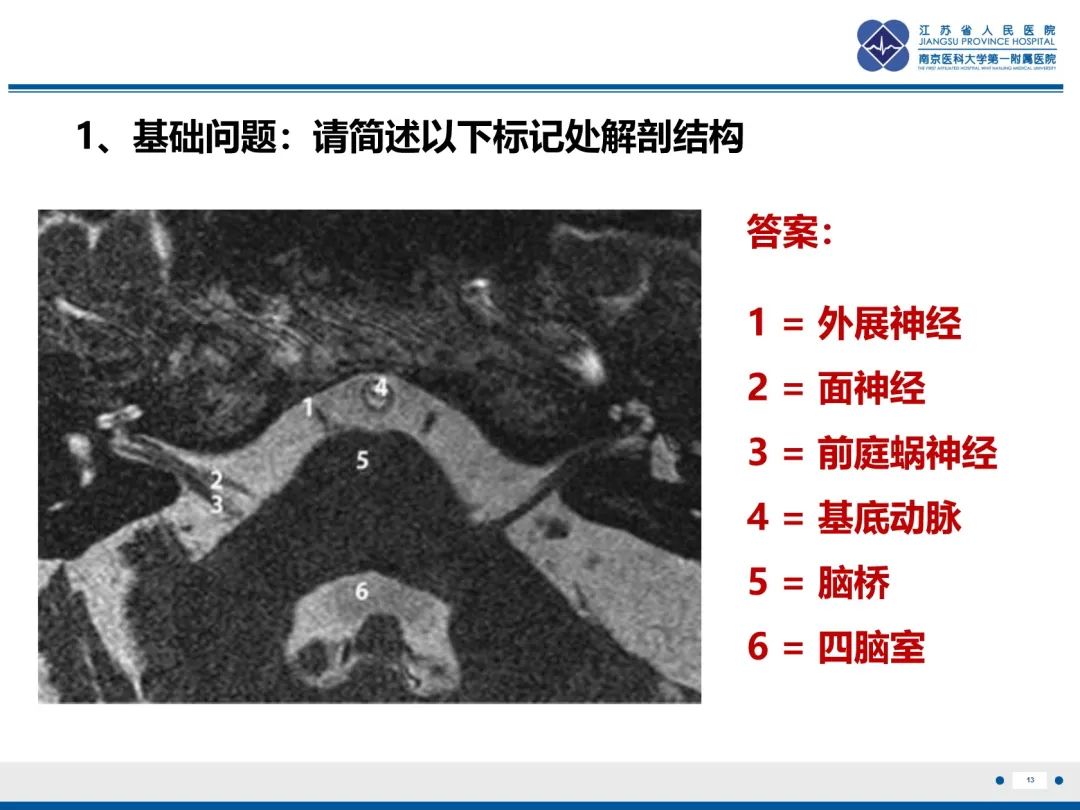影像PPT - 【PPT】岩尖胆脂瘤-14
