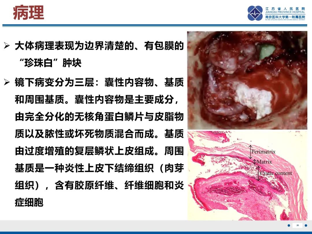 影像PPT - 【PPT】岩尖胆脂瘤-27