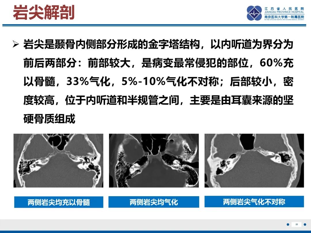 影像PPT - 【PPT】岩尖胆脂瘤-23
